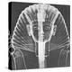 X-ray of an Egyptian Mask-Science Source-Premier Image Canvas