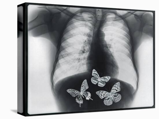X-ray of butterflies in the stomach-Thom Lang-Premier Image Canvas