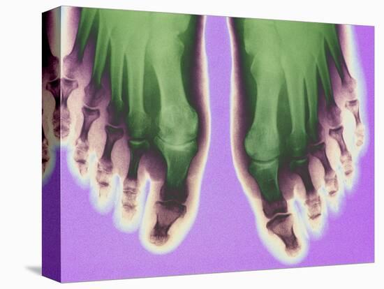 X-ray of Feet-null-Premier Image Canvas