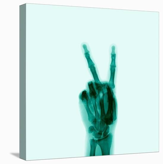 X-Ray of Hand Doing Peace Sign-null-Premier Image Canvas