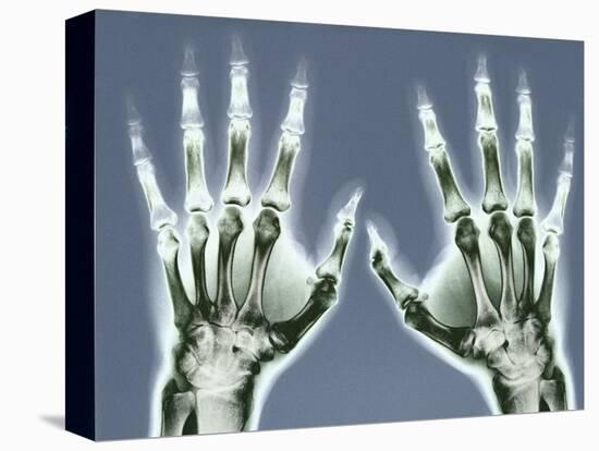 X-ray of Hands-null-Premier Image Canvas