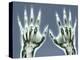 X-ray of Hands-null-Premier Image Canvas