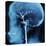 X-Ray of Human Head-Robert Llewellyn-Premier Image Canvas