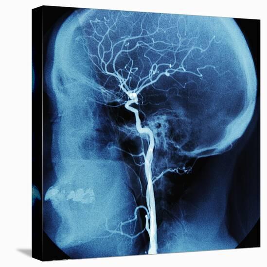 X-Ray of Human Head-Robert Llewellyn-Premier Image Canvas