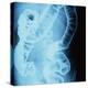 X-Ray of Intestines-Robert Llewellyn-Premier Image Canvas