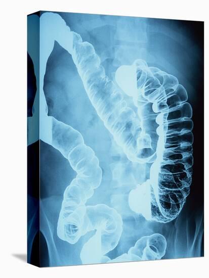 X-Ray of Intestines-Robert Llewellyn-Premier Image Canvas