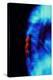 X-ray of Osteoporosis of the Thoracic Spine-Science Photo Library-Premier Image Canvas