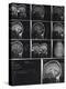X-Ray Photographs of Person's Skull-null-Premier Image Canvas