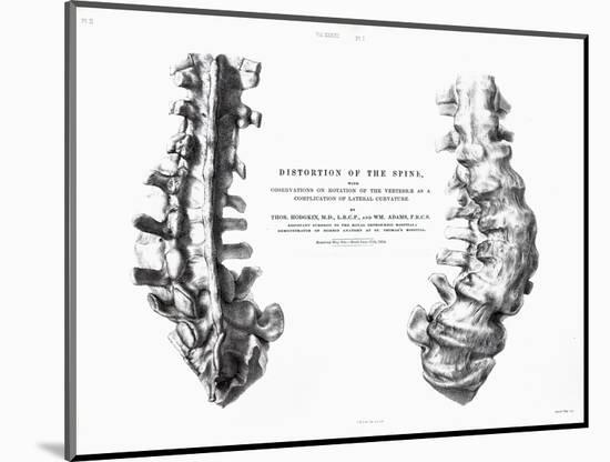 1852 Gideon Mantell Fused Spine Composite-Stewart Stewart-Mounted Photographic Print