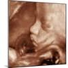 3-D Foetal Ultrasound-null-Mounted Premium Photographic Print