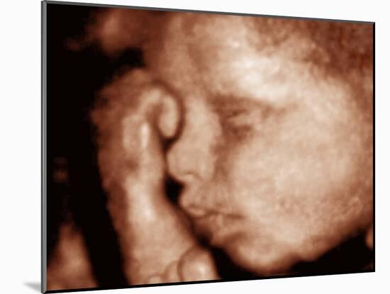 3-D Foetal Ultrasound-null-Mounted Photographic Print