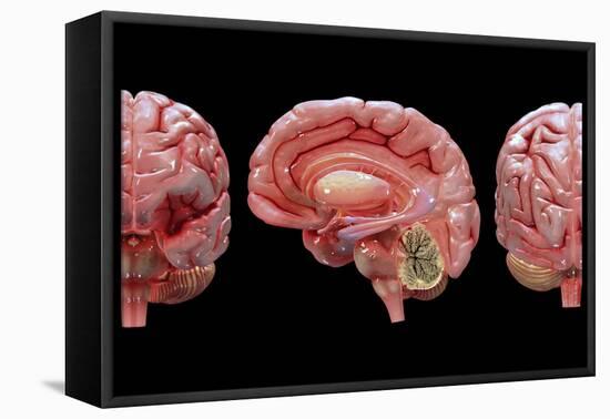 3D Rendering of Human Brain-Stocktrek Images-Framed Stretched Canvas