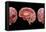 3D Rendering of Human Brain-Stocktrek Images-Framed Stretched Canvas