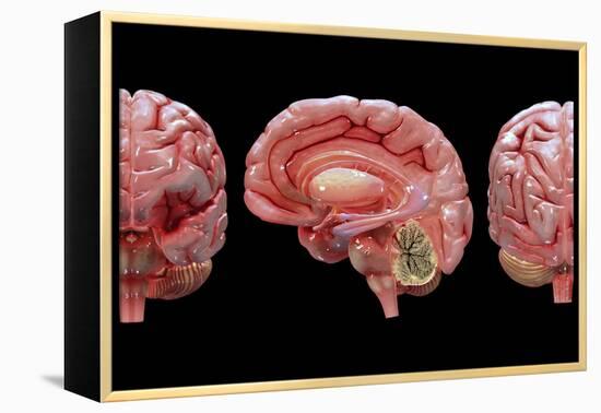 3D Rendering of Human Brain-Stocktrek Images-Framed Stretched Canvas