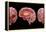 3D Rendering of Human Brain-Stocktrek Images-Framed Stretched Canvas