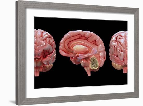 3D Rendering of Human Brain-Stocktrek Images-Framed Art Print