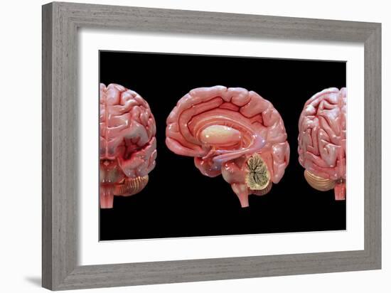 3D Rendering of Human Brain-Stocktrek Images-Framed Art Print