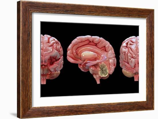 3D Rendering of Human Brain-Stocktrek Images-Framed Art Print