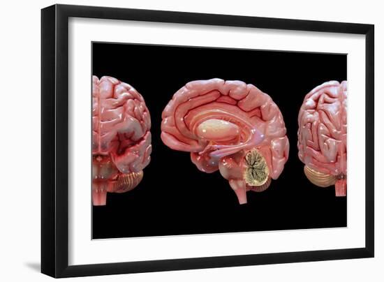 3D Rendering of Human Brain-Stocktrek Images-Framed Art Print