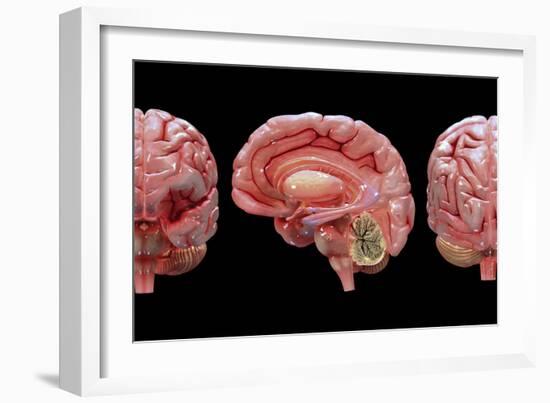 3D Rendering of Human Brain-Stocktrek Images-Framed Art Print