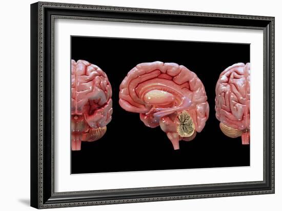 3D Rendering of Human Brain-Stocktrek Images-Framed Art Print