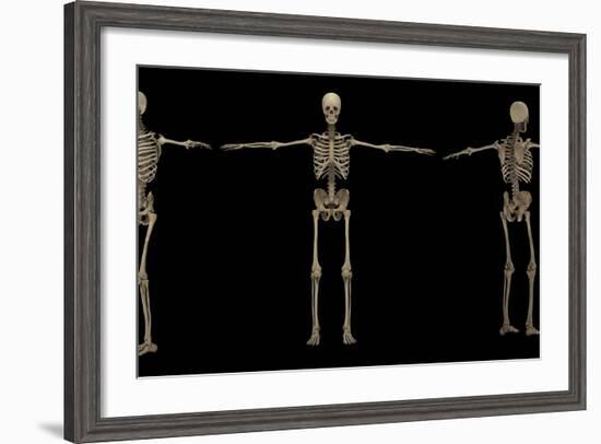 3D Rendering of Human Skeletal System at Different Angles-Stocktrek Images-Framed Art Print