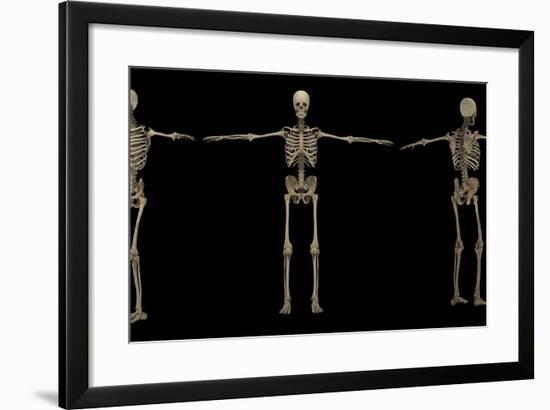 3D Rendering of Human Skeletal System at Different Angles-Stocktrek Images-Framed Art Print