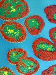Helicobacter Pylori Bacteria-A.B. Dowsett-Photographic Print