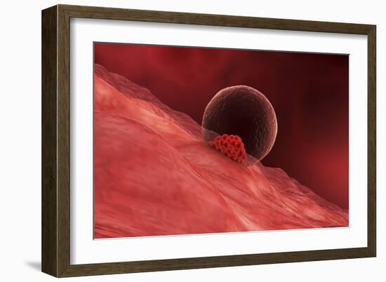 A Blastocyst Begins Implanting in the Wall of the Uterus-Stocktrek Images-Framed Art Print