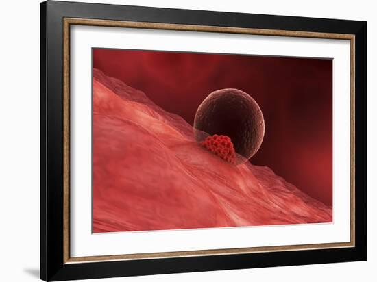 A Blastocyst Begins Implanting in the Wall of the Uterus-Stocktrek Images-Framed Art Print