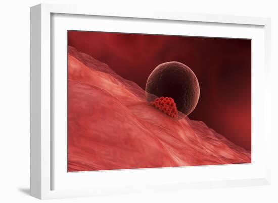 A Blastocyst Begins Implanting in the Wall of the Uterus-Stocktrek Images-Framed Art Print