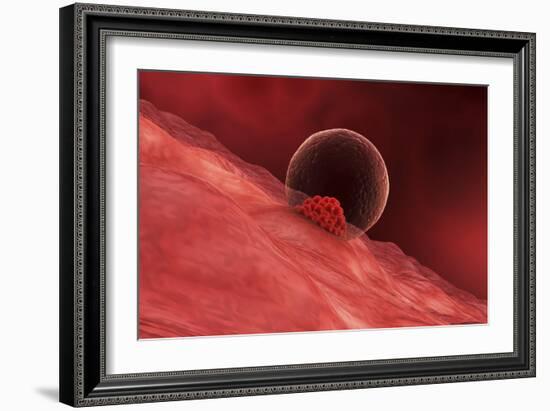 A Blastocyst Begins Implanting in the Wall of the Uterus-Stocktrek Images-Framed Art Print