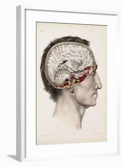 A Hand Coloured Lithograph of a Dissected Head in Profile Showing the Brain-Nicolas Henri Jacob-Framed Giclee Print