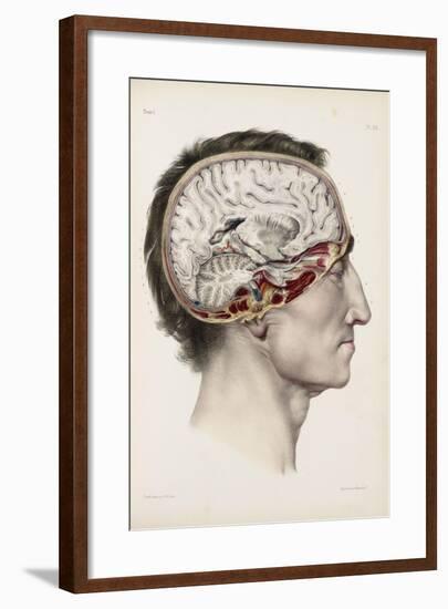 A Hand Coloured Lithograph of a Dissected Head in Profile Showing the Brain-Nicolas Henri Jacob-Framed Giclee Print