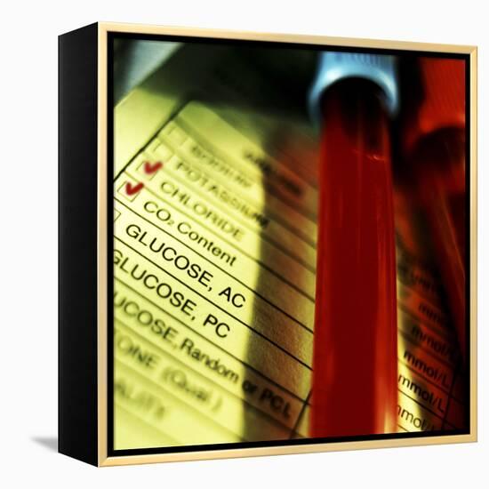 A Medical Test Checklist with Test Vials-null-Framed Premier Image Canvas