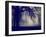 A Very Foggy Day in the Park-graphicphoto-Framed Photographic Print