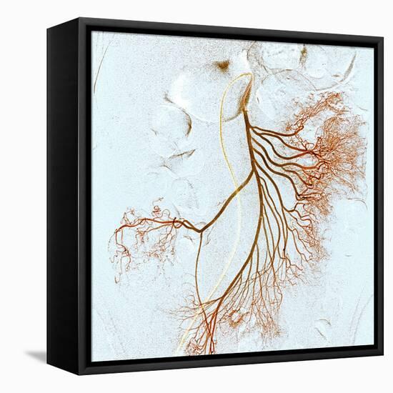 Abdominal Blood Vessels, X-ray-Du Cane Medical-Framed Premier Image Canvas
