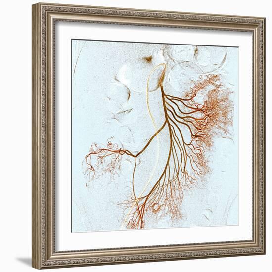 Abdominal Blood Vessels, X-ray-Du Cane Medical-Framed Premium Photographic Print