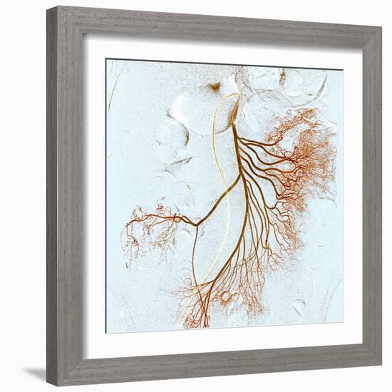 Abdominal Blood Vessels, X-ray-Du Cane Medical-Framed Premium Photographic Print