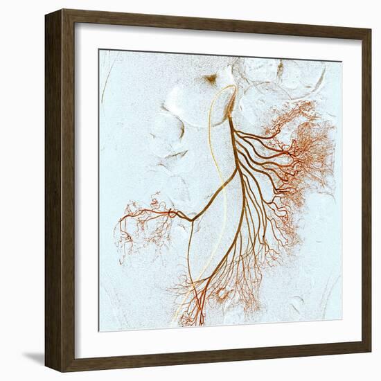 Abdominal Blood Vessels, X-ray-Du Cane Medical-Framed Premium Photographic Print