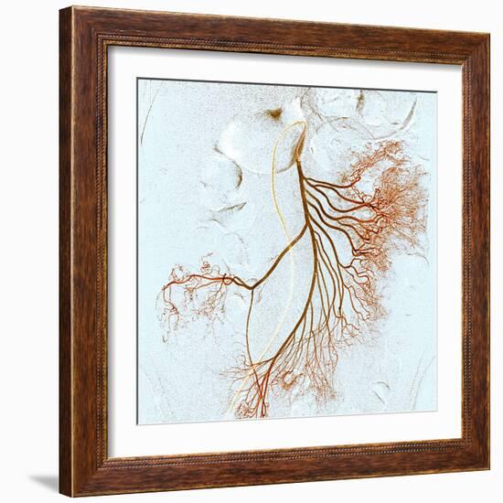 Abdominal Blood Vessels, X-ray-Du Cane Medical-Framed Premium Photographic Print