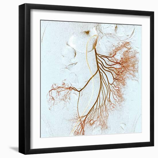 Abdominal Blood Vessels, X-ray-Du Cane Medical-Framed Premium Photographic Print