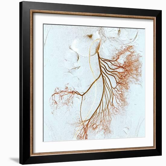 Abdominal Blood Vessels, X-ray-Du Cane Medical-Framed Premium Photographic Print