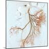 Abdominal Blood Vessels, X-ray-Du Cane Medical-Mounted Premium Photographic Print