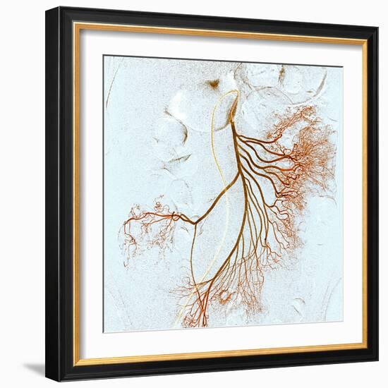 Abdominal Blood Vessels, X-ray-Du Cane Medical-Framed Premium Photographic Print