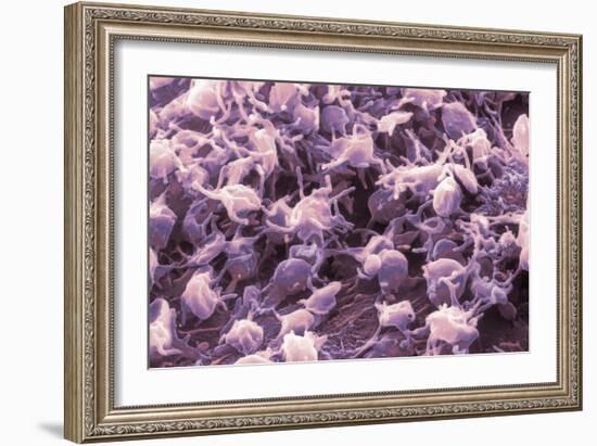 Activated Platelets, SEM-NIBSC-Framed Photographic Print