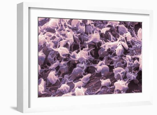 Activated Platelets, SEM-NIBSC-Framed Photographic Print