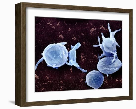 Activated Platelets, SEM-Science Photo Library-Framed Photographic Print
