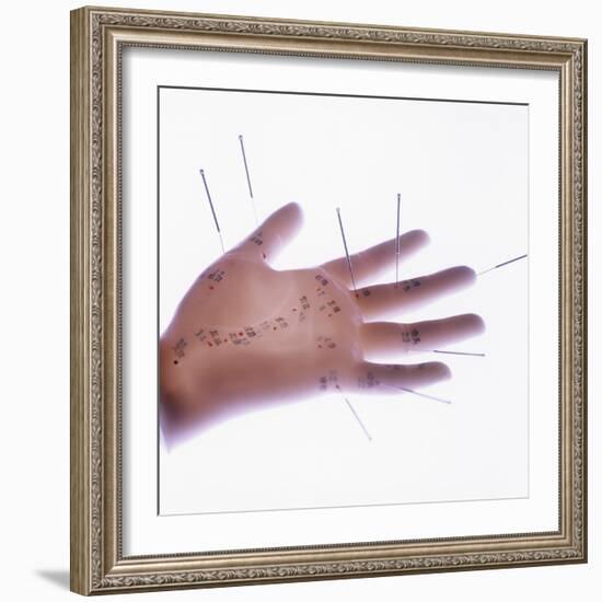 Acupuncture Model-Cristina-Framed Premium Photographic Print