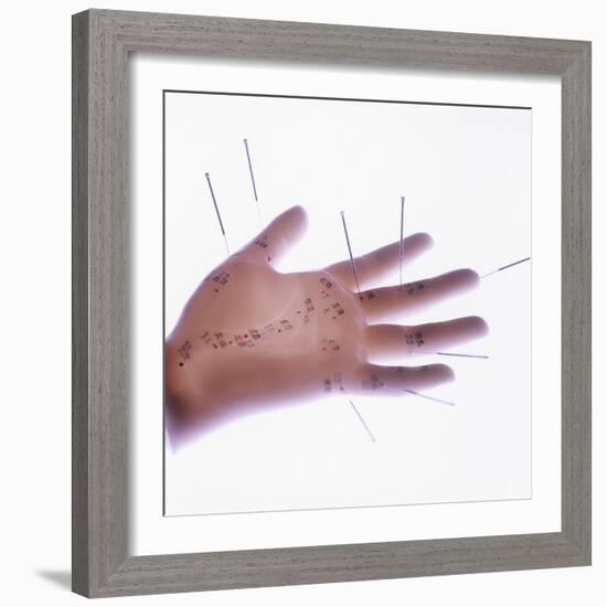 Acupuncture Model-Cristina-Framed Premium Photographic Print